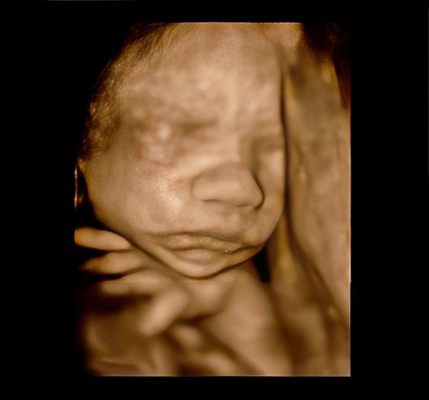 PMI - Grossesse : le fœtus s’exprime déjà dans le ventre de sa mère