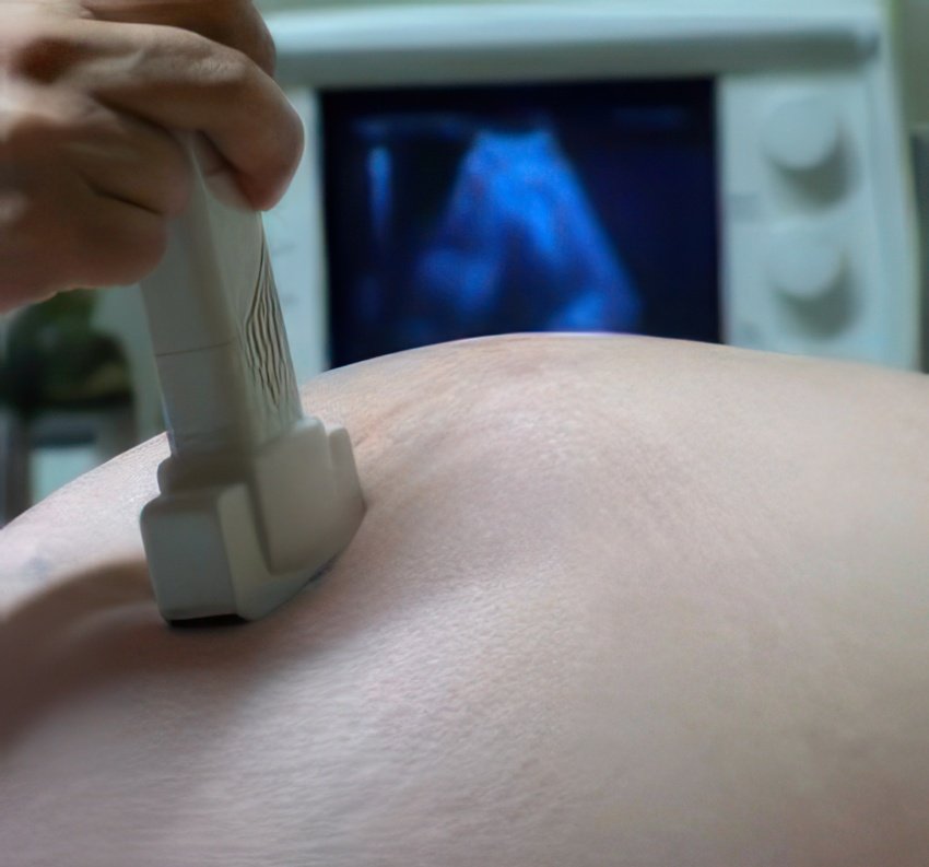 PMI - La pré-éclampsie décelable via la taille du thymus du foetus