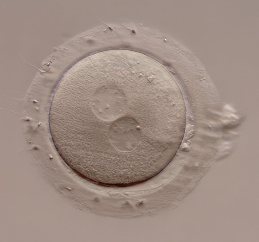 PMI - La congélation d’ovules, une solution de la dernière chance ?