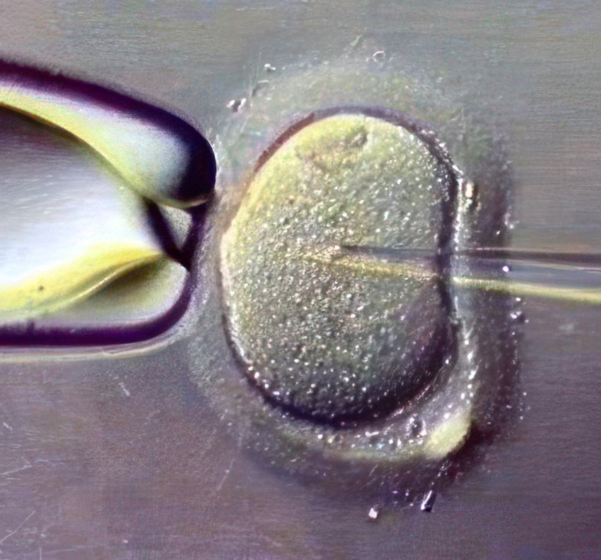 PMI - La FIV est plus efficace lorsque les embryons sont congelés