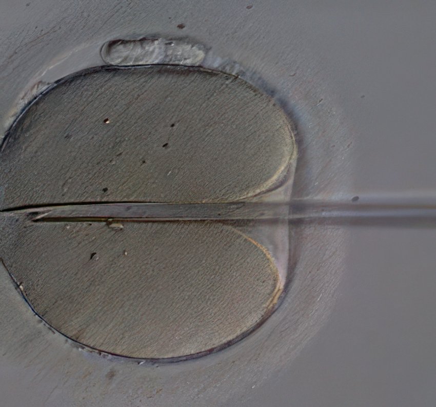 PMI - Recherche embryonnaire accélérée pour choisir son bébé à la carte ?