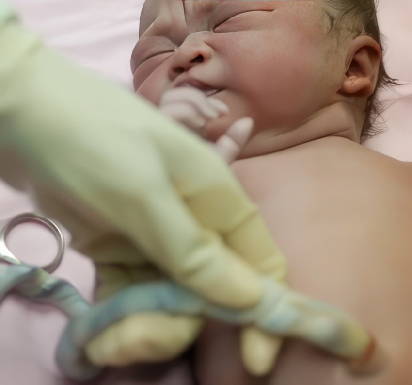 PMI - Un accouchement sans douleur pour le nouveau-né ?